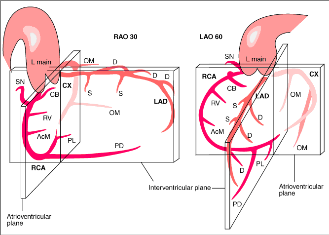 Coronary anatomy1.png