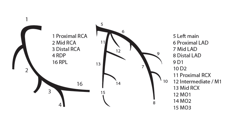 Coronary anatomy - PCIpedia