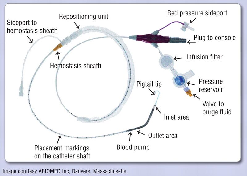 Coronary anatomy PCIpedia