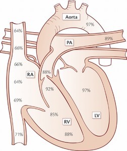 HemodynamicShunt Fig2.jpg