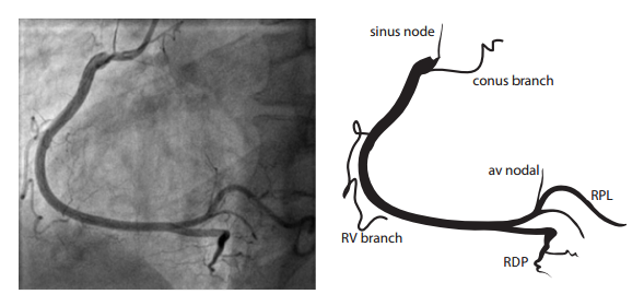 Coronary anatomy - PCIpedia