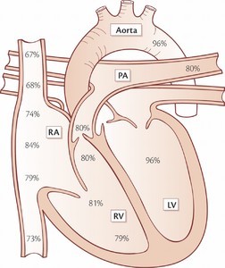 HemodynamicShunt Fig1.jpg