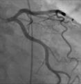 Thumbnail for version as of 20:01, 24 November 2007
