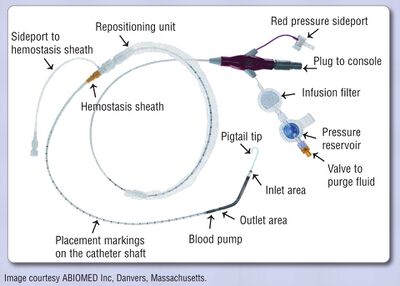 Example of a 2.5L Impella system[26]